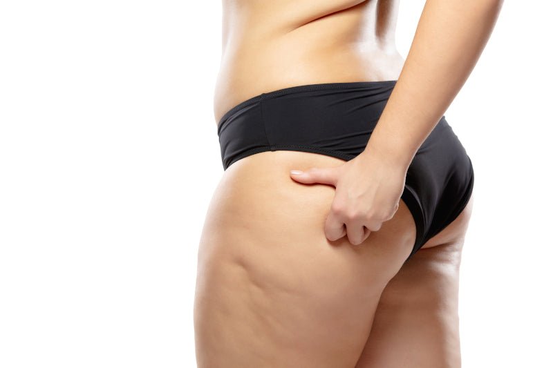découvrez des conseils efficaces pour éliminer la culotte de cheval grâce à des exercices ciblés, des astuces nutrition et des solutions naturelles pour affiner vos hanches et retrouver confiance en vous.